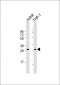 TRAP Antibody (N-term)